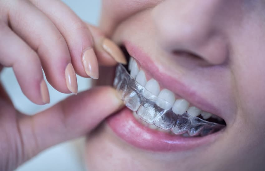 Retainers in Philmont, NY - Philmont Family Dentistry