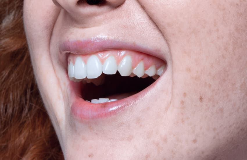 Wisdom Tooth Extractions in Philmont, NY - Philmont Family Dentistry