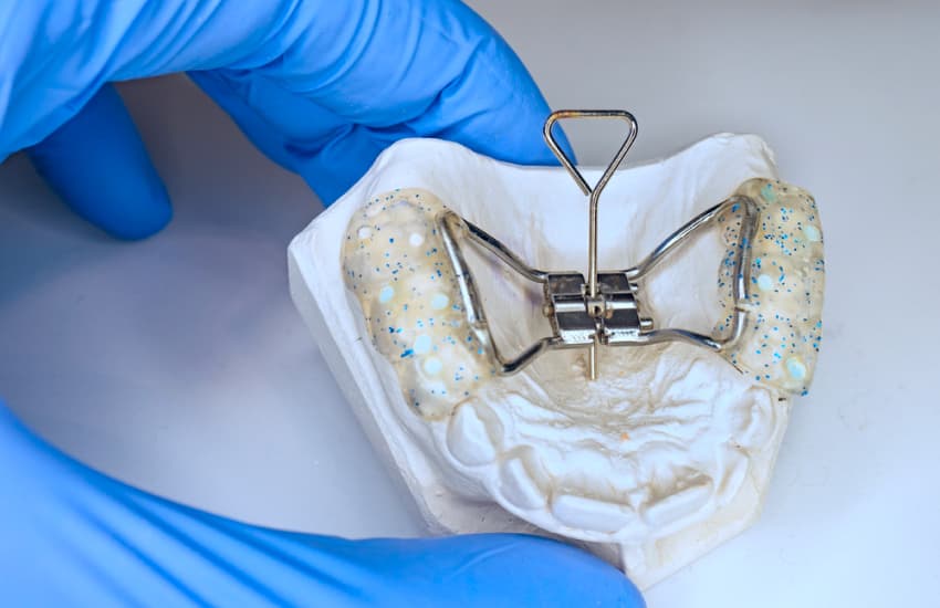 Palatal Expanders in Philmont, NY - Philmont Family Dentistry